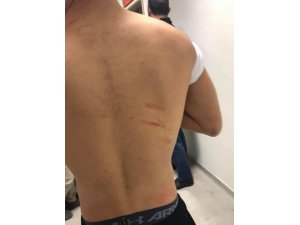 Amedspor - Sakaryaspor maçında şok iddia: "Futbolcuları jiletle yaraladılar"