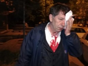 Usta gazeteciye alçak saldırı
