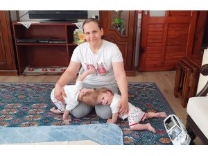 Kafadan yapışık siyam ikizleri ameliyatla ayrılarak sağlıklı bir şekilde yaşamlarını sürdürmelerini hayal ediyor