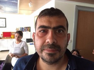 Iraklı hasta şifayı Kayseri Doktoröz Göz ve Cerrahi Merkezi’nde buldu
