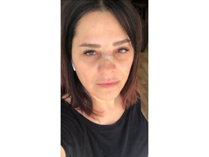 Ünlü şarkıcı Reyhan Karaca’nın burnu kırıldı