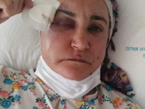 Sokak ortasında kadınlara saldıran şahıs tutuklandı