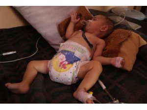 Muhammed bebek ameliyat edildi