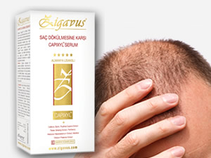 Genetik saç dökülmesinin çaresi bulundu