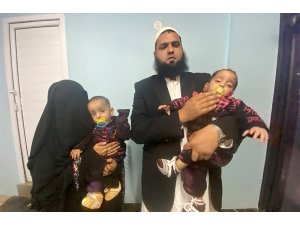 Pakistan’da 9 aylık yapışık ikizler ameliyatla ayrıldı