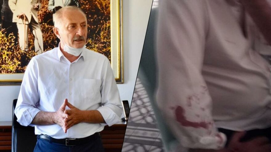 CHP’li belediye başkanına beyzbol sopalı saldırıda 7 gözaltı: Saldırganlar tanıdık çıktı