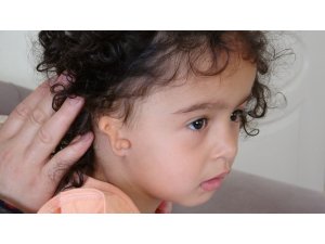 Doğuştan kulağı olmayan minik Zelal’in annesi yardım bekliyor