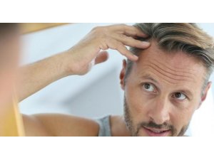 Uzmanından saç ekimine dair 6 maddede doğru bilinen yanlışlar