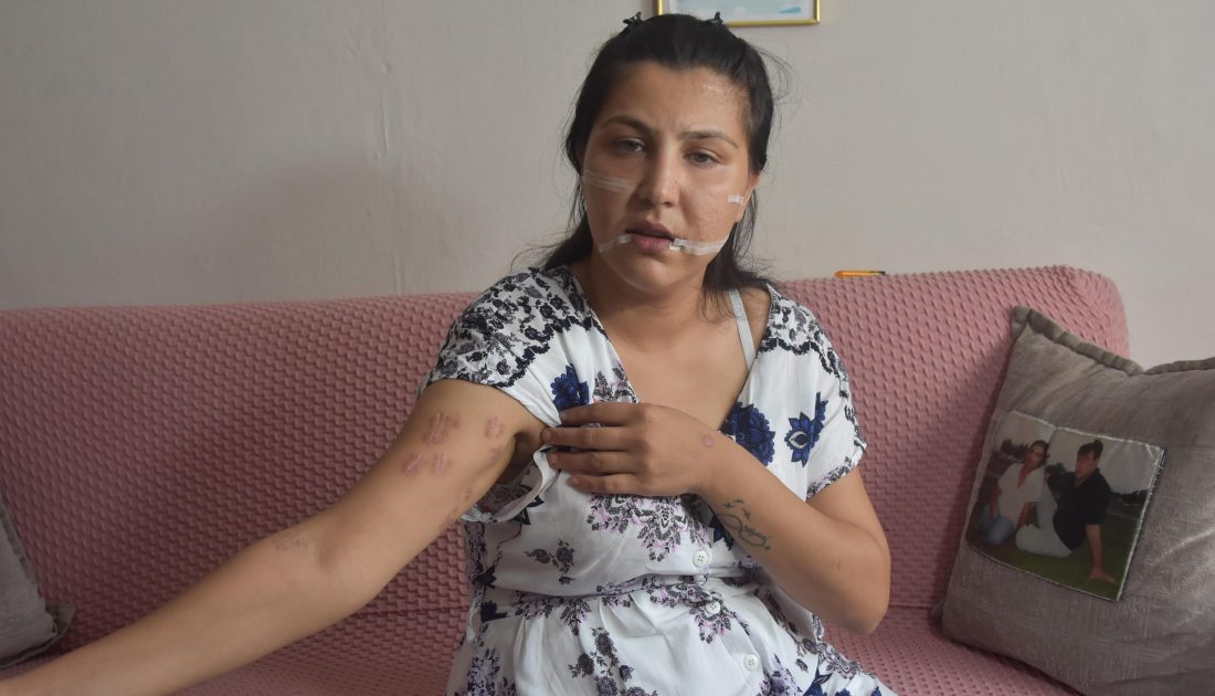 Eşi 104 defa bıçakladı, genç kadının yaşadığı dehşeti anlattı