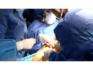 Kapalı koroner bypass ameliyatları kez Kıbrıs’ta
