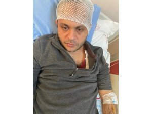 Gaziantep’te hasta yakınından doktora mermerli saldırı