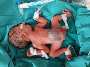 Siirt’te ambulans uçak 2 günlük bebek için havalandı