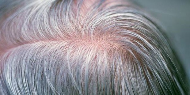 Bir gecede saçlar beyazlar mı?