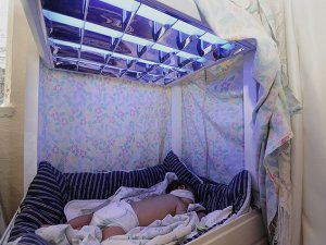 "Mavi Işık" hastası bebek tedaviye alındı