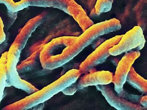Ebola virüsü 15 dakikada tespit edilecek