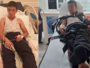 Kuduz teşhisi konulan çocuk hayatını kaybetti!