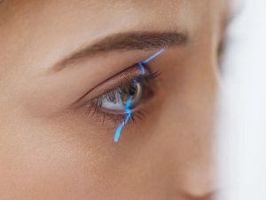 Göz Lazer (Göz Çizdirme) Operasyonları ve Süreç Rehberi