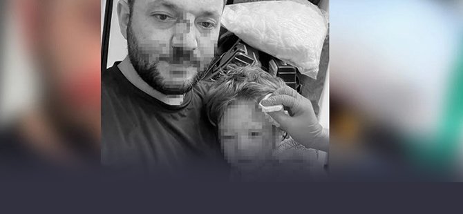 Yalova’da bebek saldırısı: Gürlek’ten açıklama!