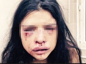 Melis Çakır'ın annesi isyan etti: Onur kızımı öldürecek