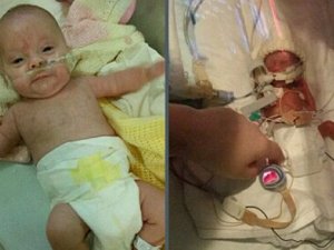 Eli babasının alyansından geçebilen prematüre bebek hayata tutundu!