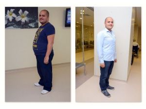 Obezite Cerrahisiyle Yeni ’Beden’lerine Kavuştular