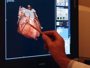 Kalp Damarlarında Oluşan Darlık Kalp Hastalığının En Sık Sebeplerinden