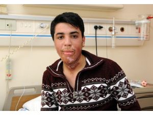 Bombalı Saldırıda Boynu Yanan Genç, Antalya’da Sağlığına Kavuştu