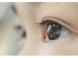 Psikoloji Düzelten Göz Tedavisi, Göz Protezi