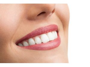 Dijital Diş Hekimliği İle Harika Sonuçlar