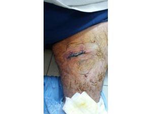 Darbe gecesi yaralı kurtulan vatandaş yaşadıklarını anlattı