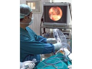 Östaki borusu tıkanıklığı balon yöntemiyle aşılıyor