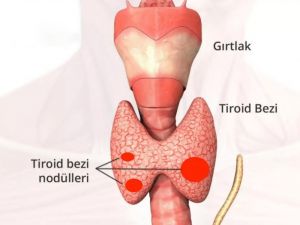 Hızlı kilo değişimi tiroidden olabilir