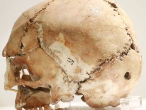 11 bin yıl önce ilk beyin ameliyatının yapıldığı Aşıklıhöyük tarihe ışık tutuyor