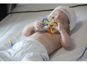11 aylık bebeğe kafa şekil bozukluğu ameliyatı
