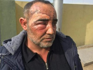 Şanlıurfalı sürücü Irak’ta yaralandı