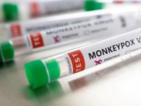 Maymun Çiçeği virüsü 2 ülkede daha görüldü… Avrupa'da vaka sayısı hızla artıyor