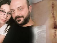 Eşini 6 yerinden bıçaklayan erkekten çıldırtan savunma