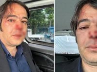 İBB İmar Müdürü'ne saldırı