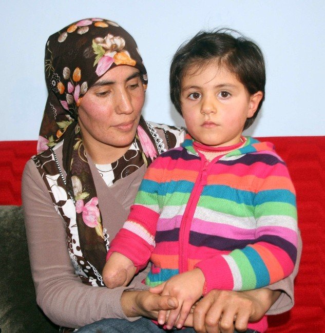 Yozgat’ta Kolu Kesilen Minik Meryem: “Anne Elim Ne Zaman Çıkacak”