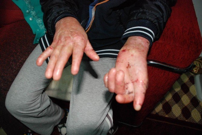 Akraba Evlilikleri Hayatlarını Kararttı