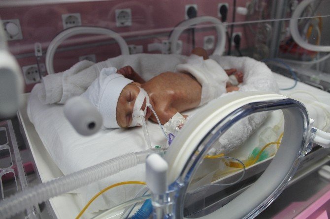 Yenidoğan Bakım Ünitesinde Prematüre Bebekler Can Buluyor