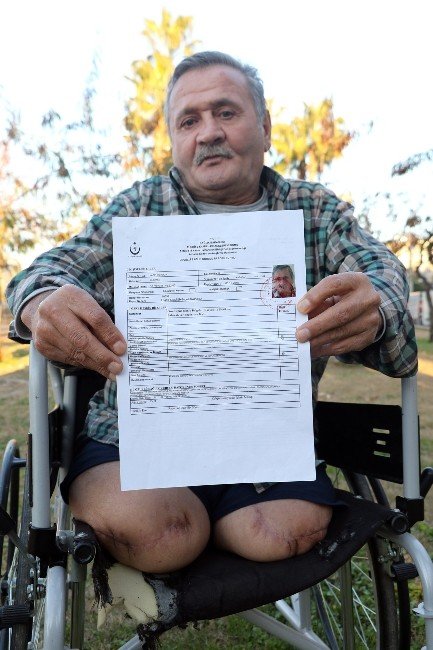 İki Bacağı Diz Altından Kesilen Şahıs Malulen Emeklilik İstiyor