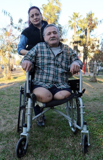 İki Bacağı Diz Altından Kesilen Şahıs Malulen Emeklilik İstiyor