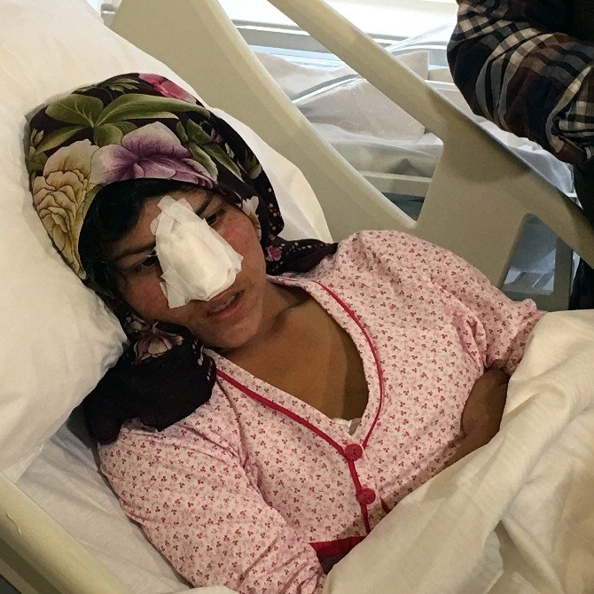 Burnu Kesilen Afgan Kadın Ankara’ya Getirildi