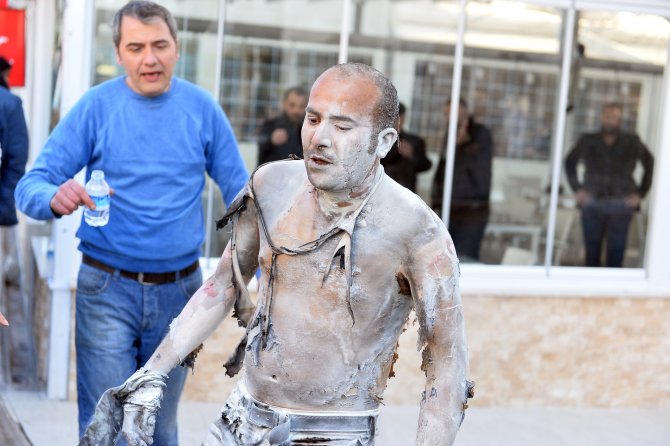 İşsizlikten dolayı kendini yakan adam öldü