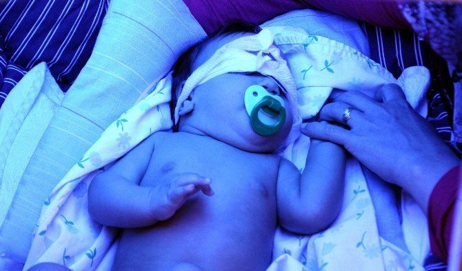 Mavi Işık Hastası Minik Poyraz’dan Çok Güzel Haber
