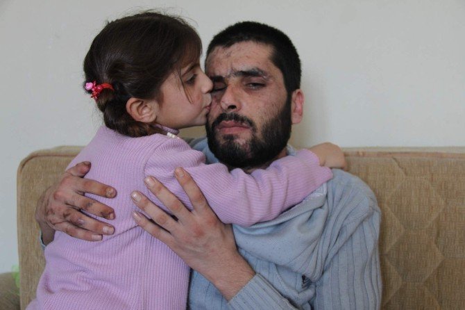Suriyeli Dumo: "Gözlerimi Babama Verin"