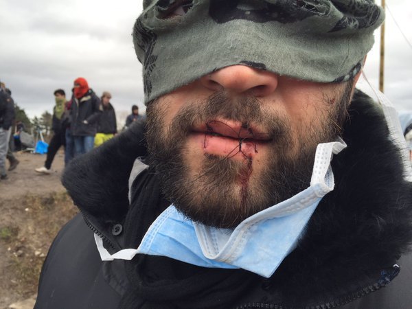 Fransa'da göçmenler, olaylı yıkımı dudaklarını dikerek protesto etti