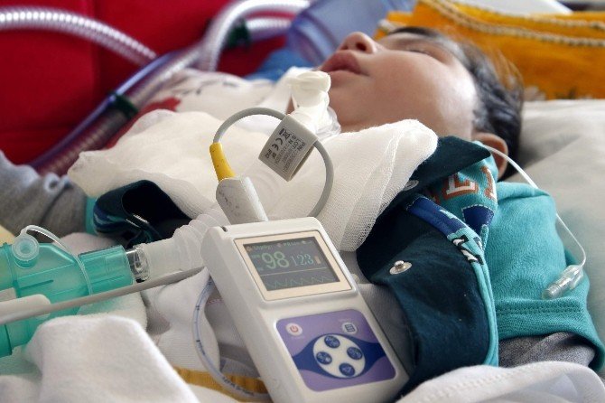 2 Yaşındaki Taha’nın, 5 Ayrı Makineyle Yaşam Mücadelesi