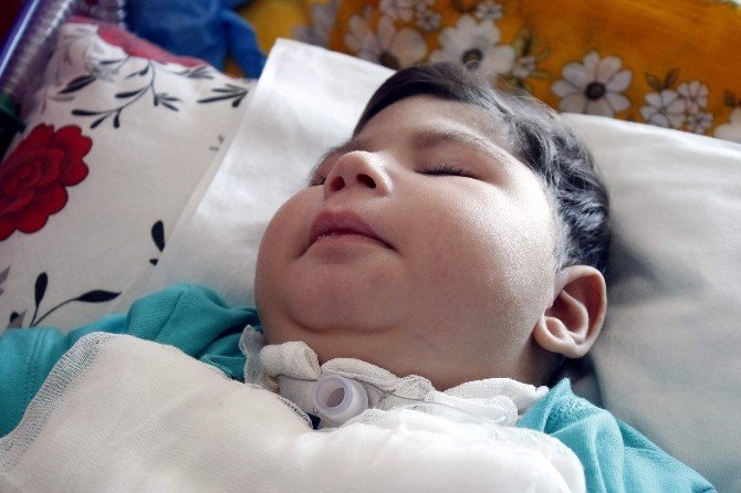 2 Yaşındaki Taha’nın, 5 Ayrı Makineyle Yaşam Mücadelesi